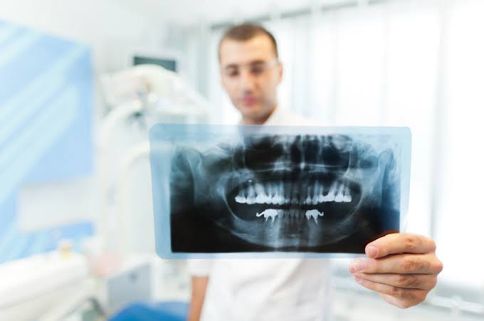 CDT Code D0210: Full Mouth X-Ray (FMX) Dental Billing Guide