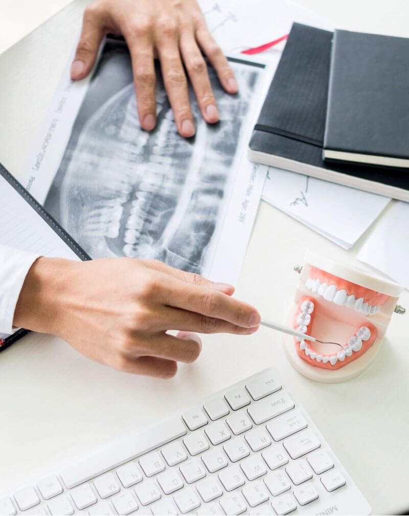 CDT Code D2790: Full Cast Crown Procedure, Coverage & Billing Guide
