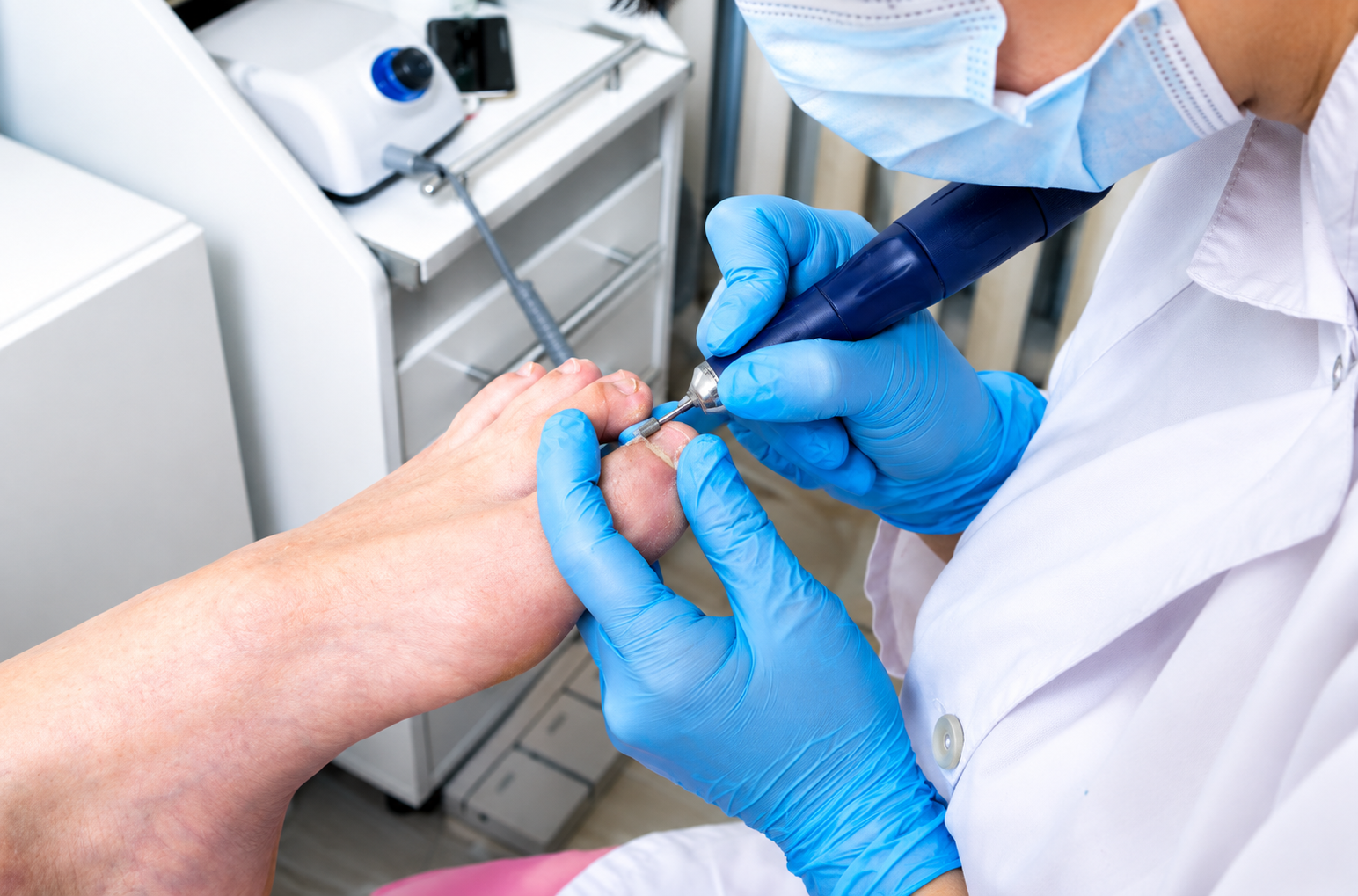 CPT 11732 Guide 2026: Additional Nail Avulsion