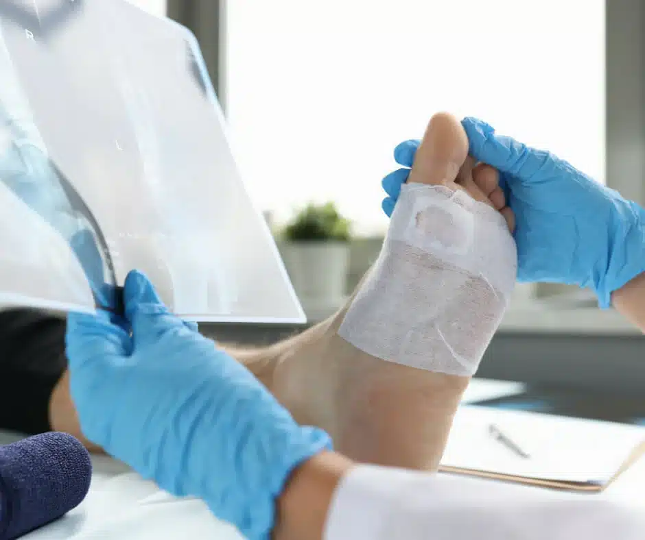 CPT 11042 Guide 2026: Subcutaneous Debridement